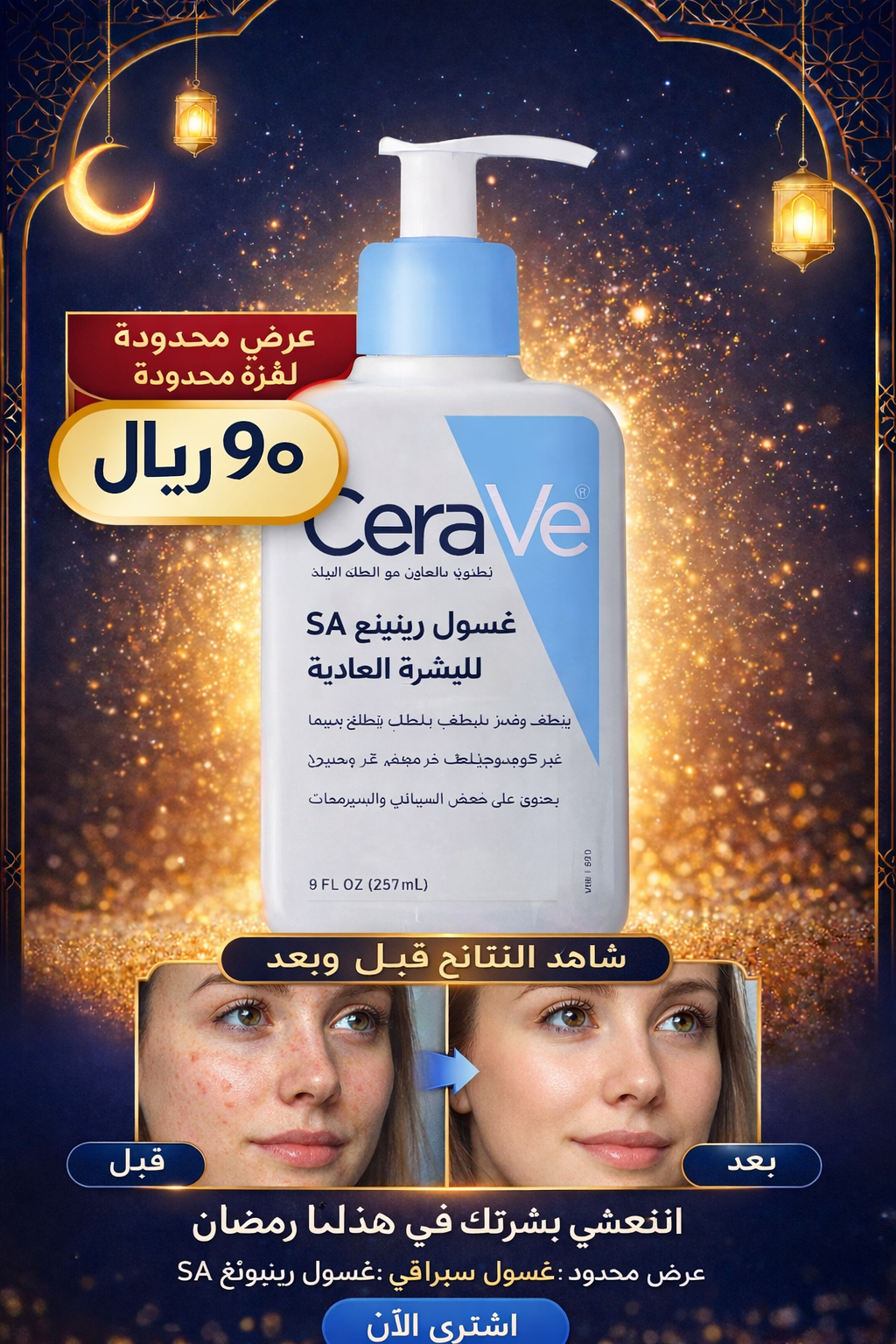 CeraVe -SA Smoothing Cleanser|غسول سيرافي - إس إيه المنعم